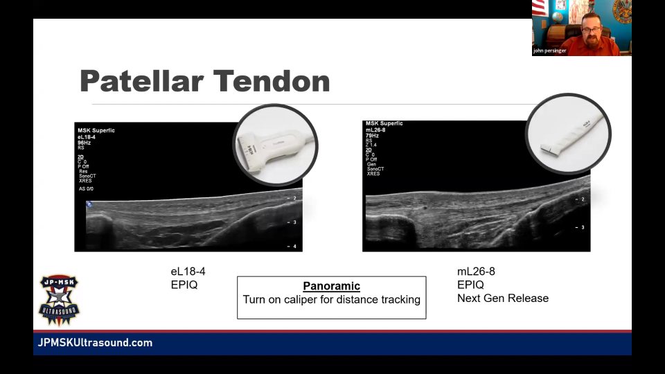 影像比較：patellar tendon、panoramic、triceps 與 Achilles，34:32 的代表畫面