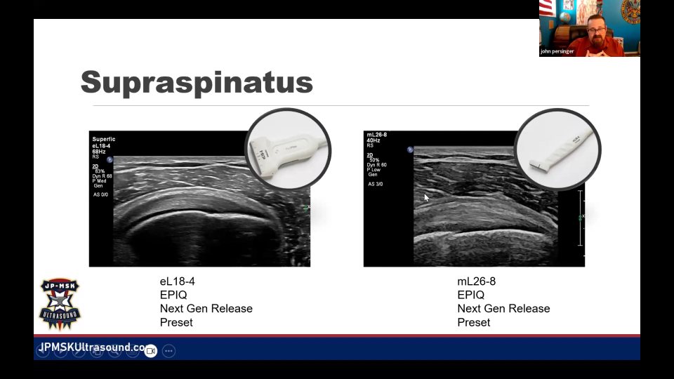 Supraspinatus tear：替代 preset、細節比較與冠狀面重建，44:52 的代表畫面
