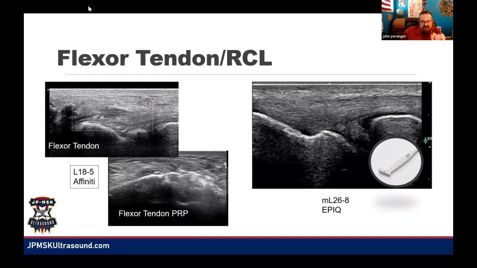 Finger pulley 與投影片標示的 flexor tendon／RCL 介入影像，58:08 的代表畫面